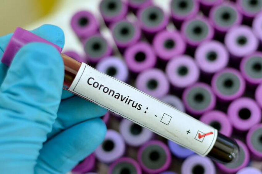 Son sutkada Azərbaycanda COVID-19 infeksiyasına 11 yoluxma faktı qeydə alınıb