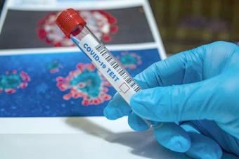 Son sutkada Azərbaycanda koronavirus infeksiyasına 1265 yeni yoluxma faktı qeydə alınıb